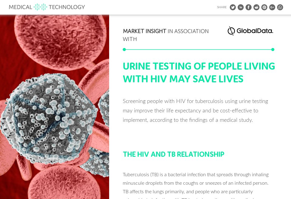 Urine testing of people living with HIV may save lives Medical