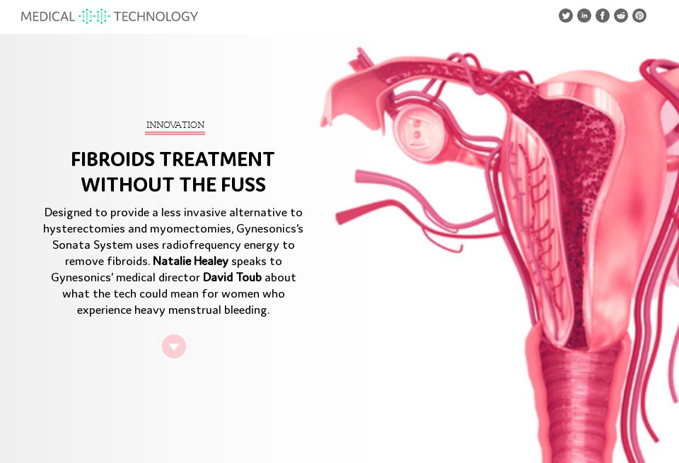 Fibroids treatment without the fuss - Medical Technology | Issue 32